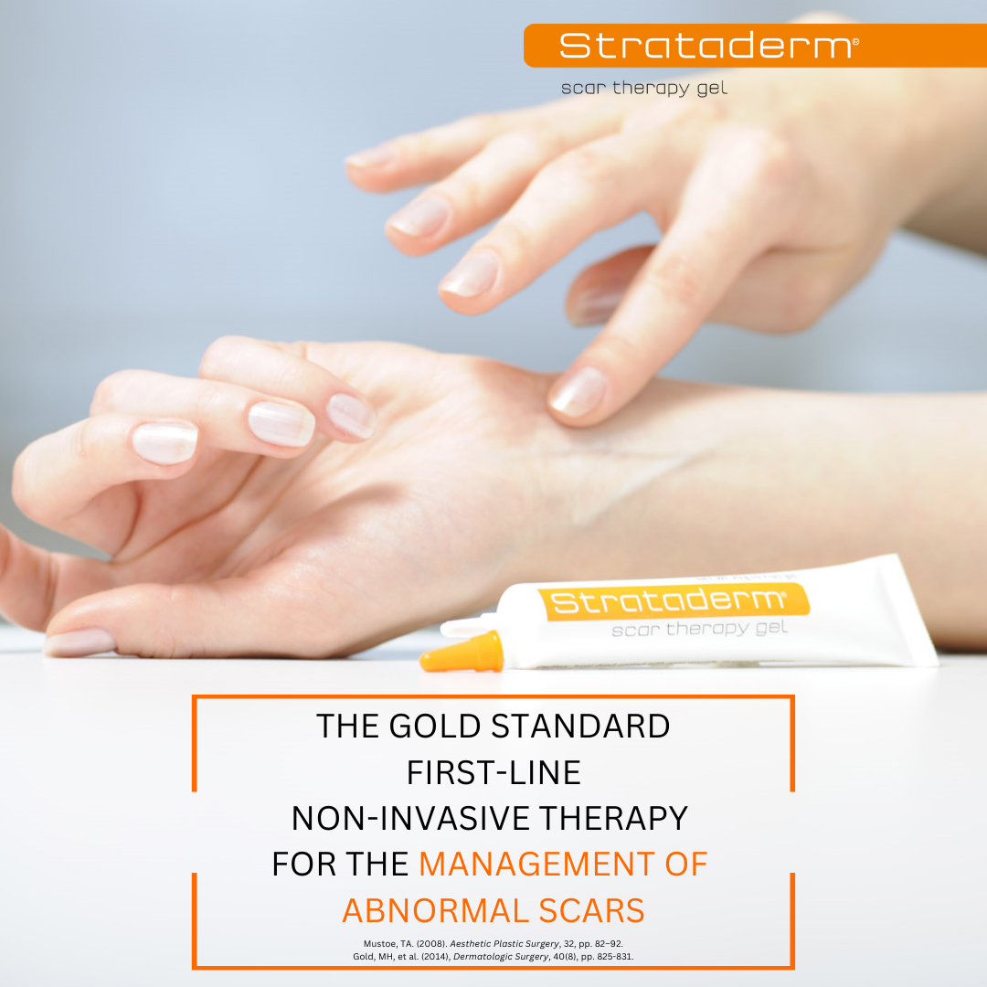 SD20EX00TubeBoxLowRes